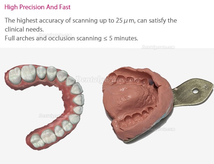 Fussen Dental 3D Digitaler Intraoralscanner